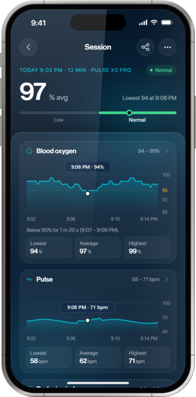 Oxiline App pulse oximeter session with SpO2 and pulse charts
