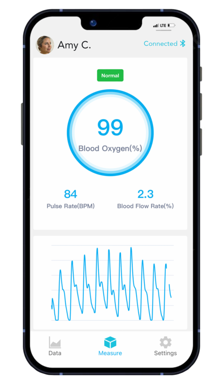 oxiline pulse xs pro app bluetooth mobile oximeter fda approved
